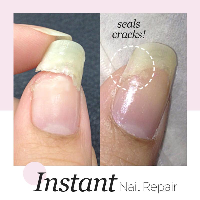 Instant Nail Repair Gel
