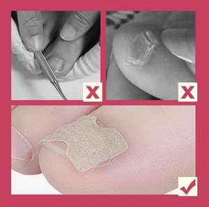 Glue Free Toenail Patch