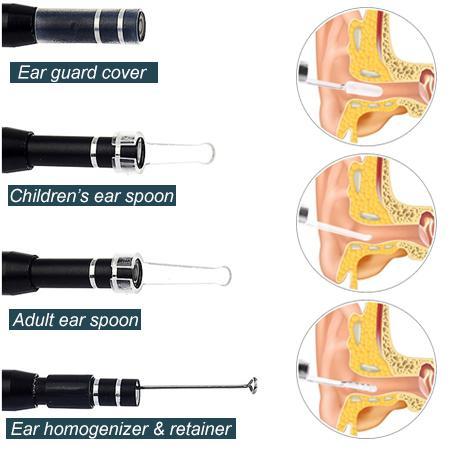 ProEar™ 3-in-1 Ear Endoscope
